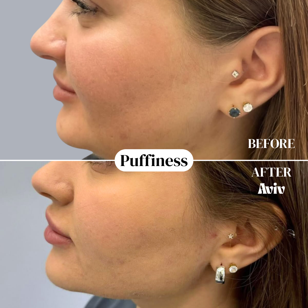 Økologiske lymfedrænagedråber som gave