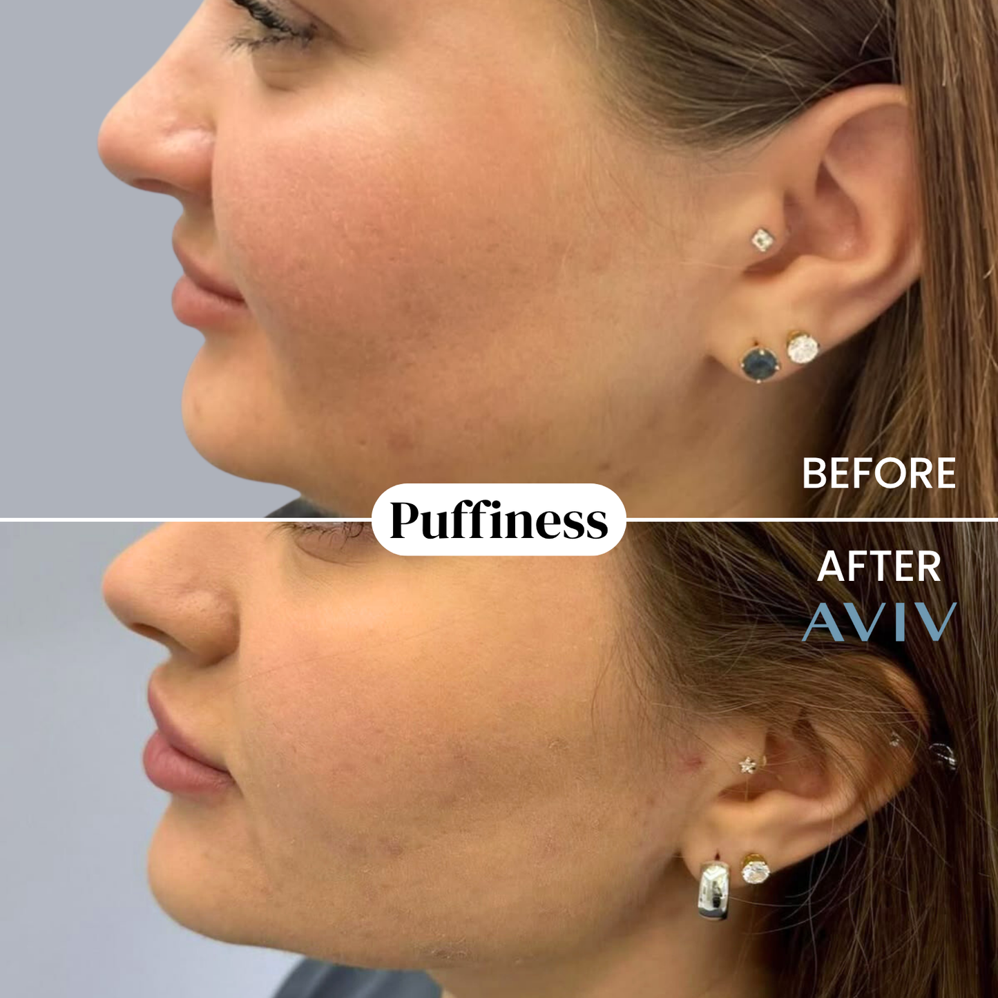 Botanisk lymfedrænage-eliksir