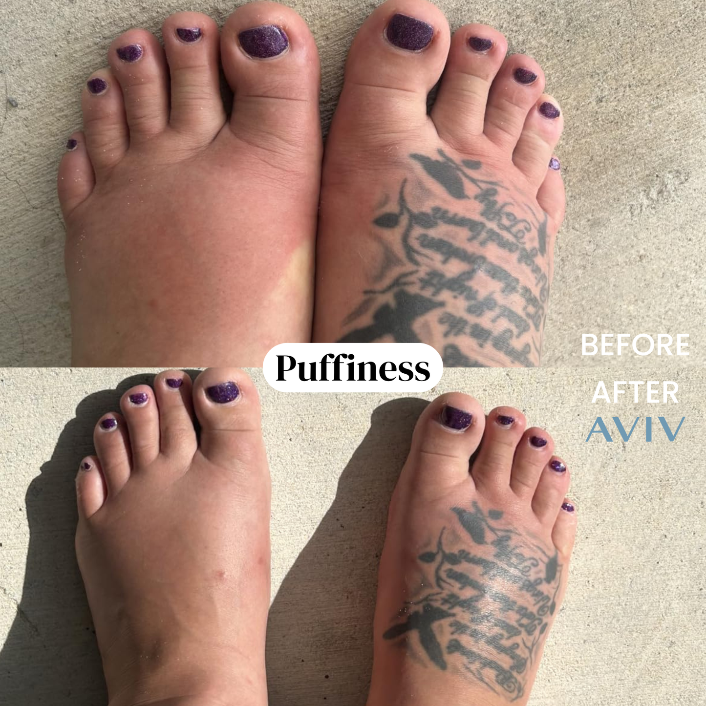 Botanisk lymfedrænage-eliksir