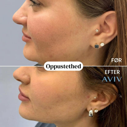 Botanisk lymfedrænage-eliksir (dansk)